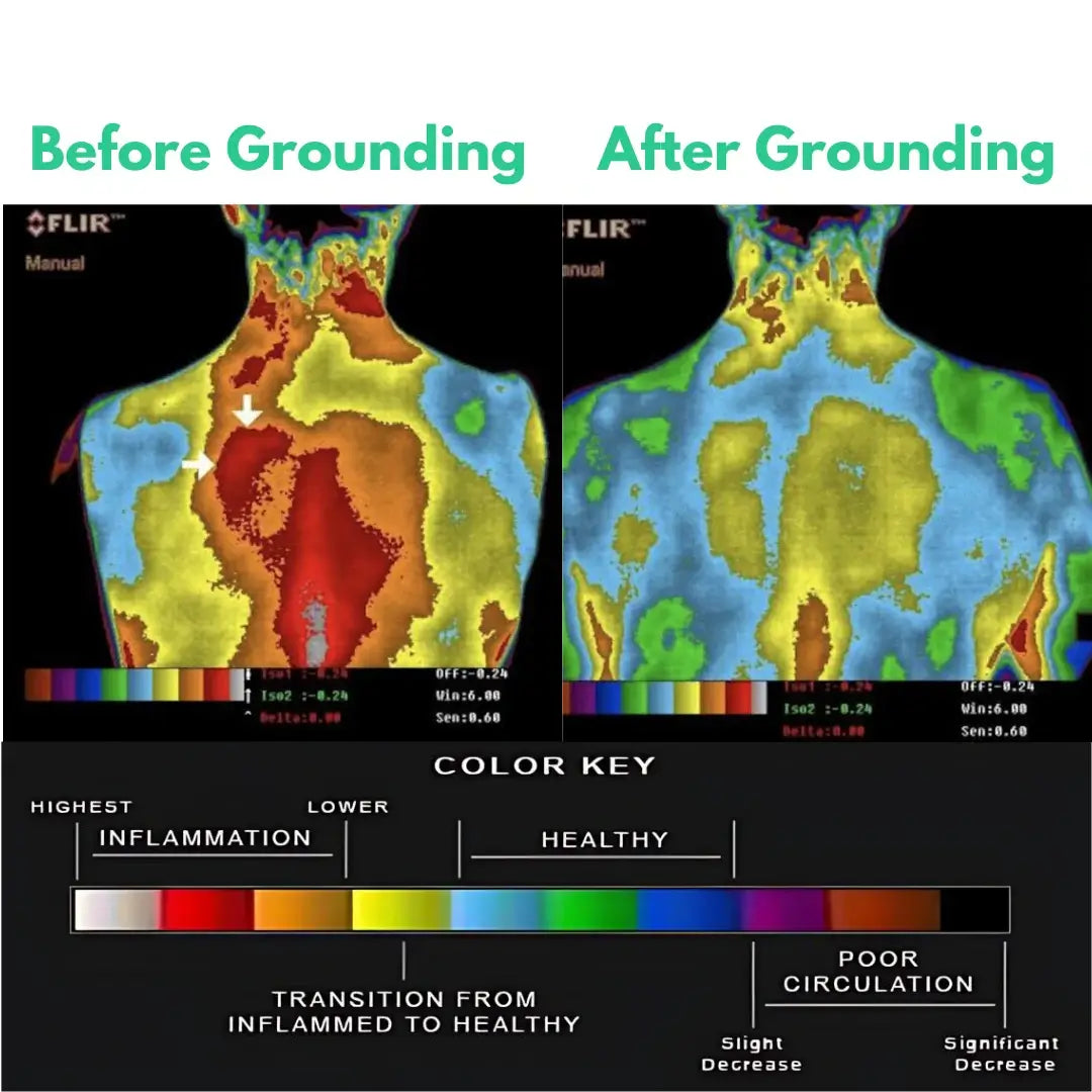 Before and after thermal scan showing reduced inflammation after using grounding sheets.