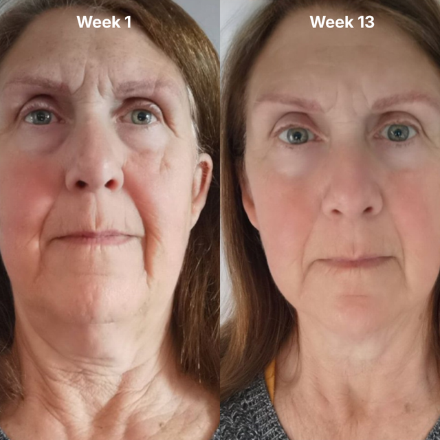 Margaret K. — before and after