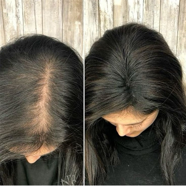 Sarah L. — before and after